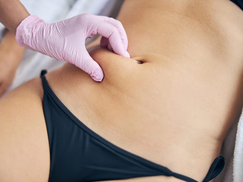 Cropped photo of a doctor in a latex glove palpating a neoplasm on a patient skin